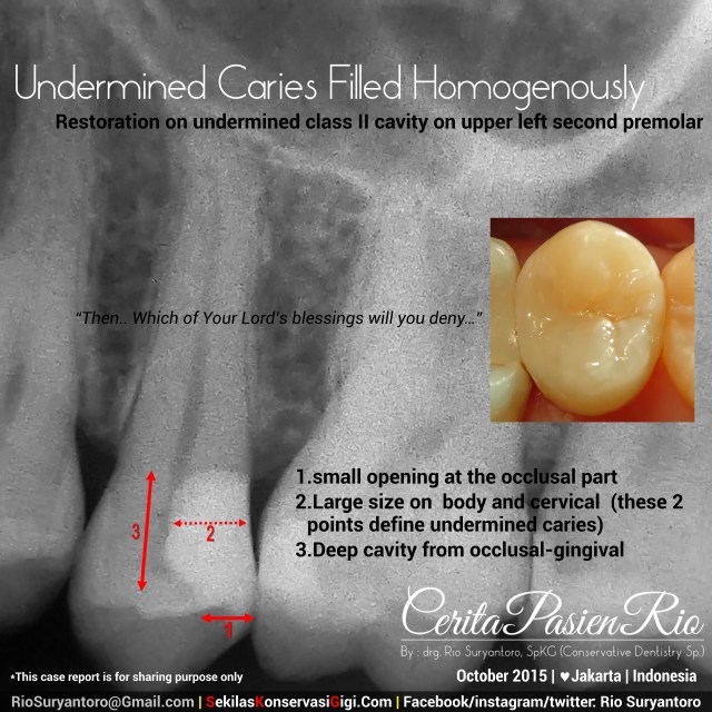 penambalan gigi sakit gigi dokter gigi spesialis konservasi gigi jakarta