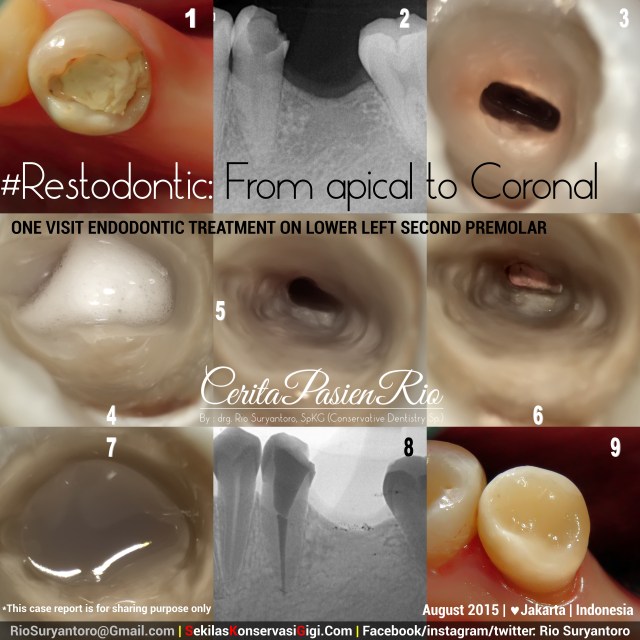 sakit gigi ke dokter gigi spesialis konservasi gigi