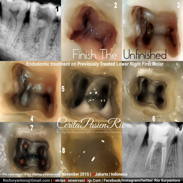 sakit gigi dokter gigi spesialis konservasi gigi perawatan akar gigi tambal jakarta