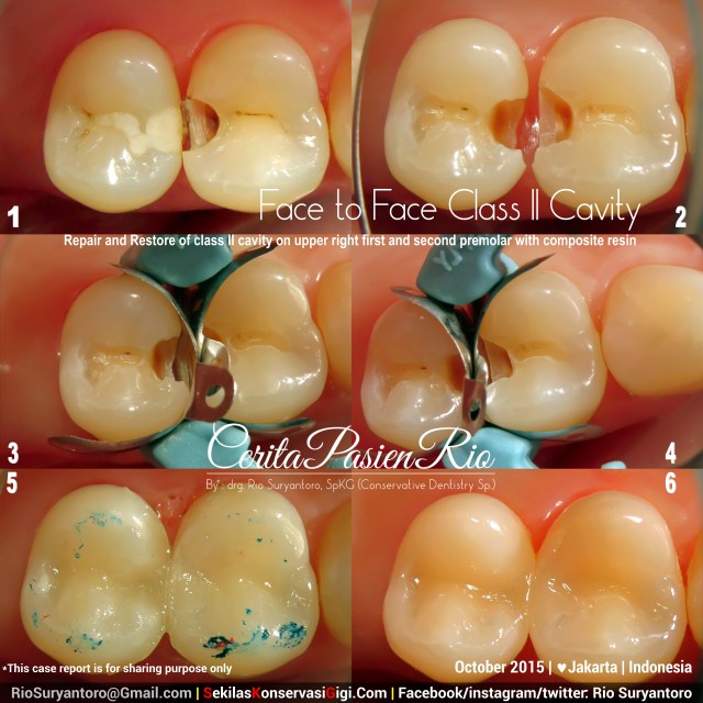 sakit gigi tambal gigi perawatan akar gigi spesialis konservasi gigi