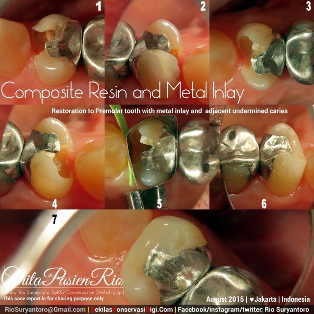 dokter gigi rio spesialis konservasi sakit gigi perawatan saluran akar