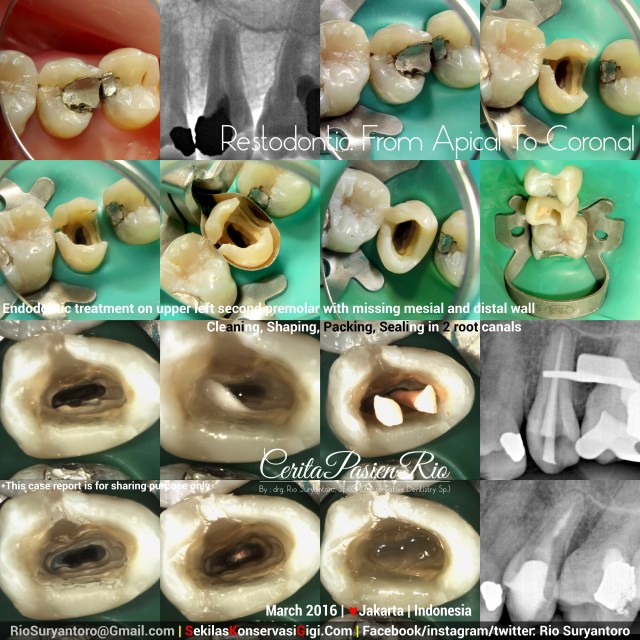dokter gigi rio spesialis konservasi gigi jakarta anita psa maret oke kelas 2