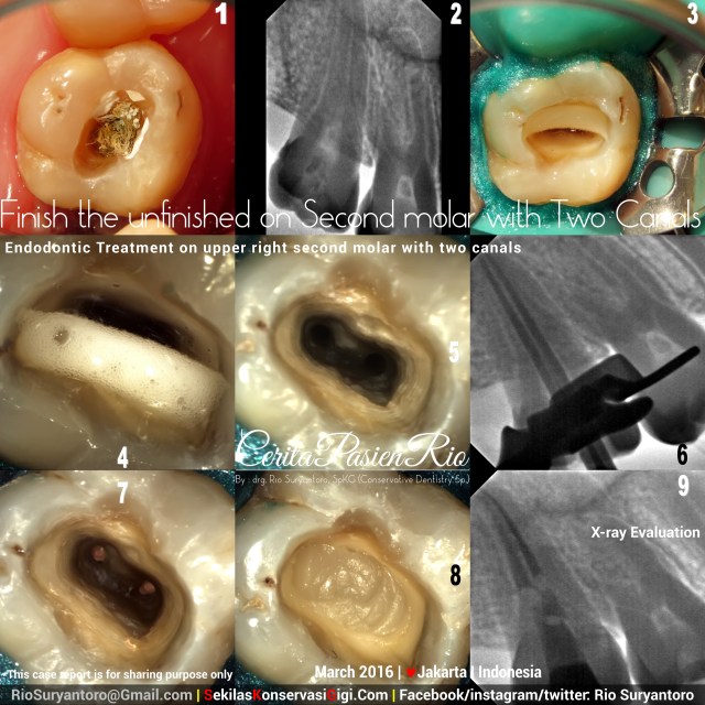 dokter gigi rio spesialis konservasi gigi jakarta gigi geraham pondok indah maret