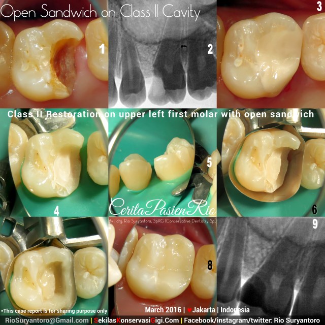 dokter gigi rio suryantoro spesialis konservasi gigi jakarta