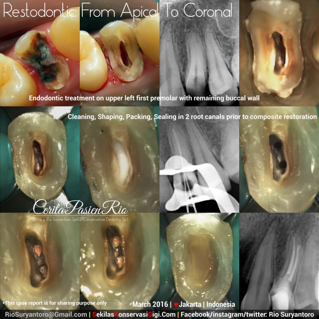 dokter gigi rio spesialis konservasi gigi jakarta paling bagus