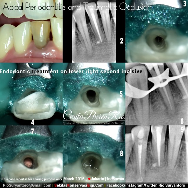 dokter gigi rio suryantoro spesialis konservasi gigi jakarta bagus estetika luke maret