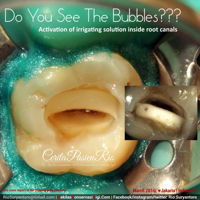 dokter gigi rio suryantoro spesialis konservasi gigi jakarta hebat mengobati sakit gigi