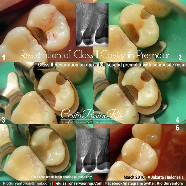 dokter gigi spesialis konservasi gigi bagus di jakarta