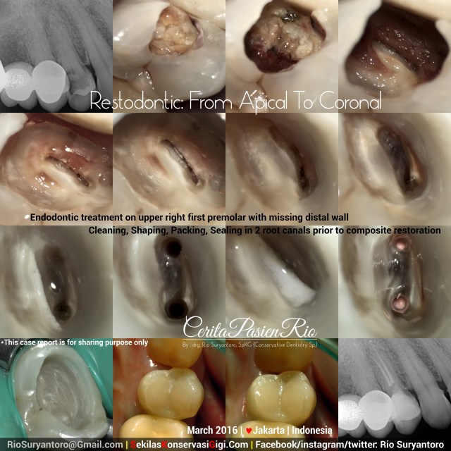 dokter gigi rio suryantoro spesialis konservasi gigi jakarta