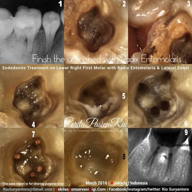 dokter gigi rio spesialis konservasi gigi sakit gigi jakarta