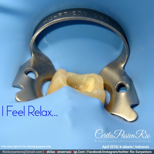 dokter gigi rio suryantoro spesialis konservasi gigi jakarta relaxing
