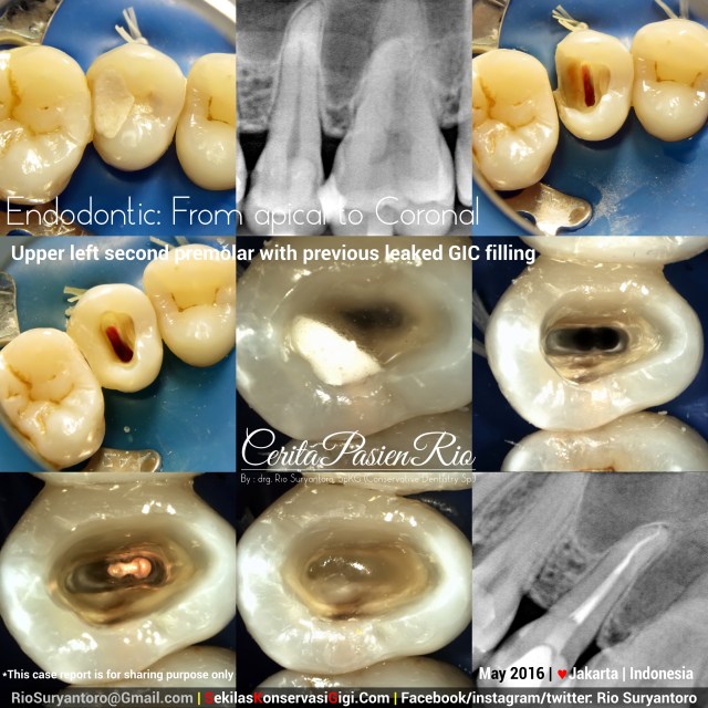 fig 1. previous endodontic cases.