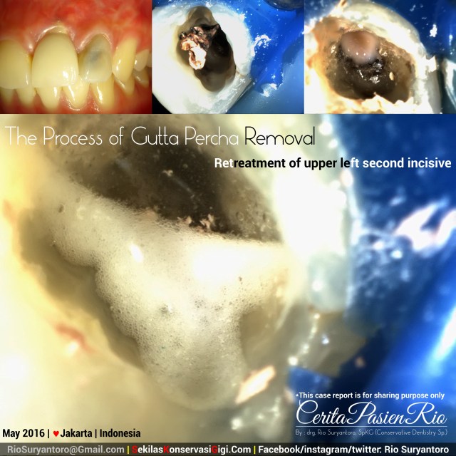 dokter gigi rio suryantoro spesialis konservasi gigi terbaik jakarta Ali mei PI awal