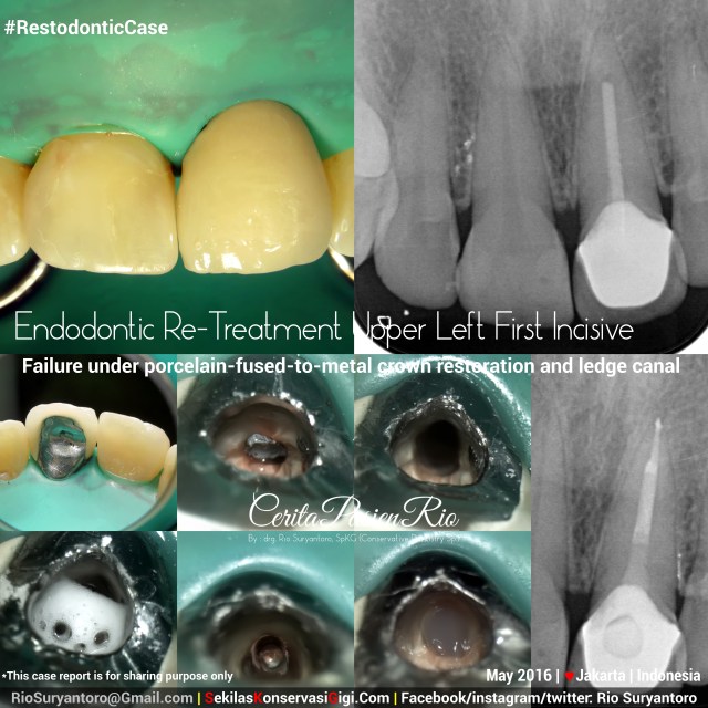 dokter gigi rio suryantoro spesialis konservasi gigi terbaik jakarta dia psa 21 ok