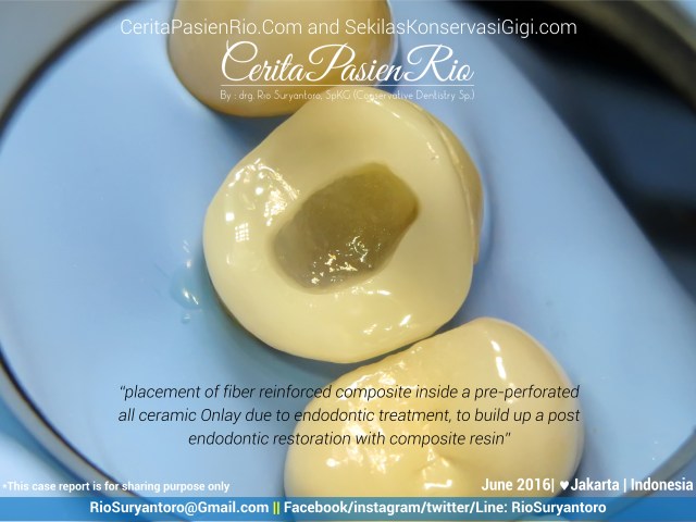 dokter gigi rio suryantoro spesialis konservasi gigi jakarta fiber jun