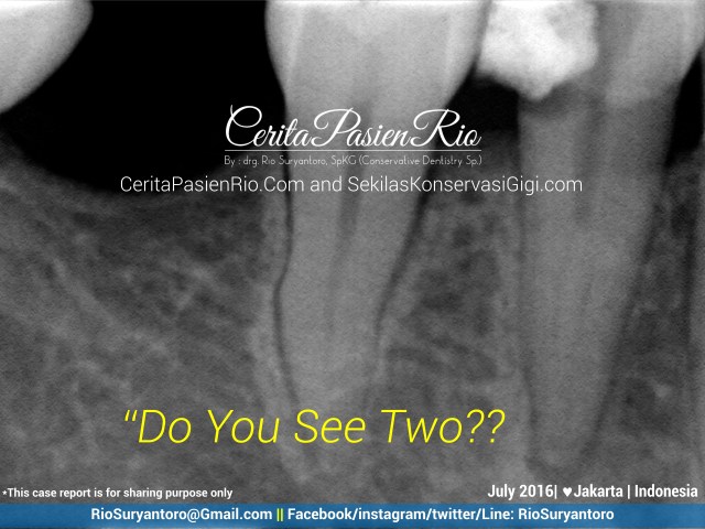 dokter gigi rio suryantoro spesialis konservasi gigi jakarta rare 44 juli