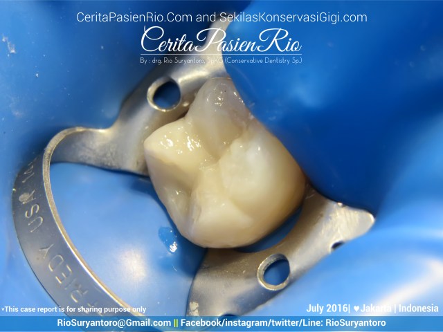 dokter gigi rio suryantoro spesialis konservasi gigi jakarta relax jul junai