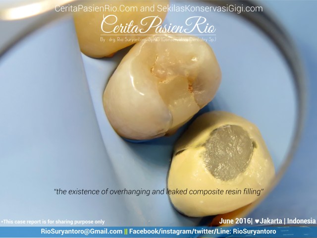 dokter gigi rio suryantoro spesialis konservasi gigi jakarta relax jun (2)