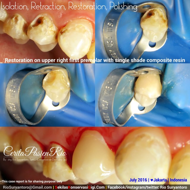 dokter gigi rio suryantoro spesialis konservasi gigi terbaik jakarta RK 14 jul anin