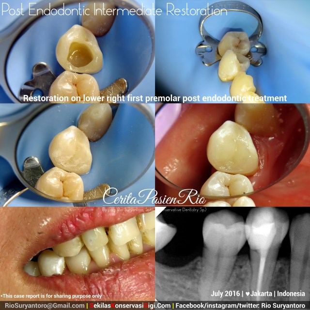 dokter gigi rio suryantoro spesialis konservasi gigi terbaik jakarta RK 44 jul suli