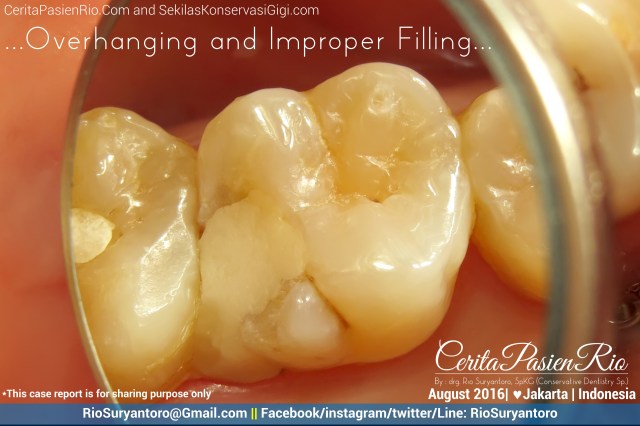 dokter gigi rio suryantoro spesialis konservasi gigi jakarta relax agst dini k