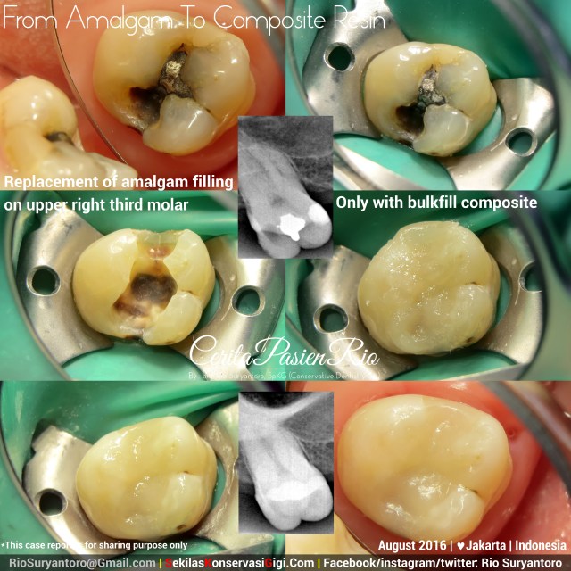 dokter gigi rio suryantoro spesialis konservasi gigi terbaik jakarta RK AF 2 Eki slipi