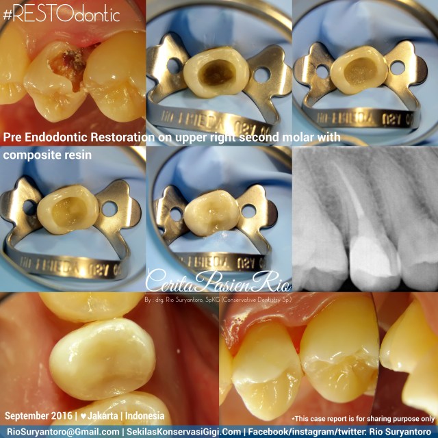 dokter-gigi-rio-suryantoro-spesialis-konservasi-gigi-terbaik-jakarta-pos-endo-aullia-sept-slipi