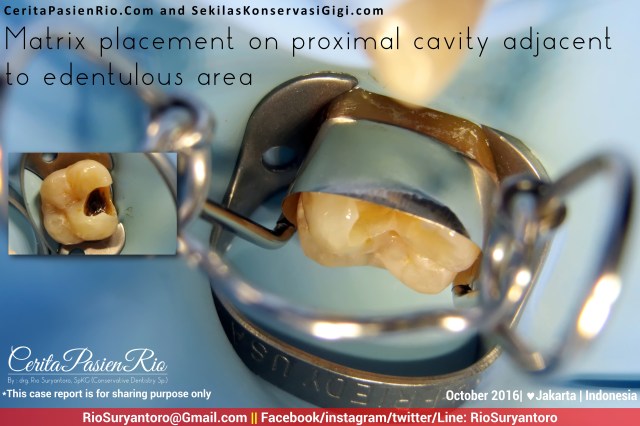 dokter-gigi-rio-suryantoro-spesialis-konservasi-gigi-jakarta-relax-oct-andy-alker