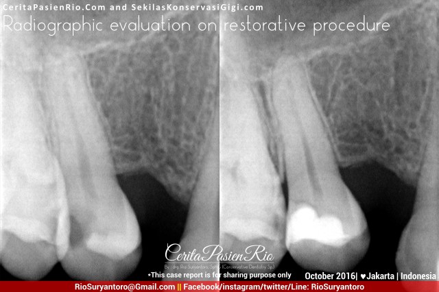 dokter-gigi-rio-suryantoro-spesialis-konservasi-gigi-jakarta-relax-oct-herd-alker