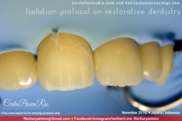 dokter-gigi-rio-suryantoro-spesialis-konservasi-gigi-jakarta-relax-oct-koas-11-alker