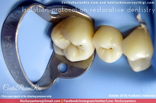 dokter-gigi-rio-suryantoro-spesialis-konservasi-gigi-jakarta-relax-oct-nadiah-16-slipi