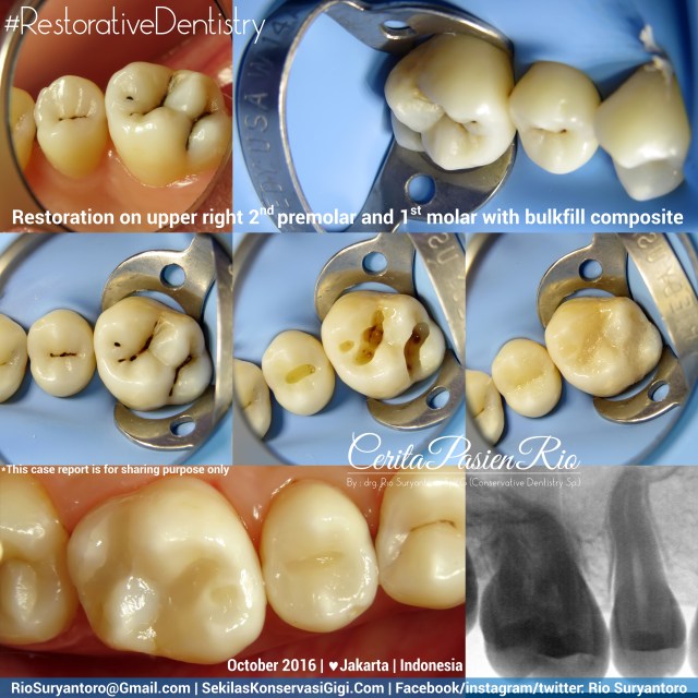 dokter-gigi-rio-suryantoro-spesialis-konservasi-gigi-terbaik-jakarta-nadiah-slipi-16