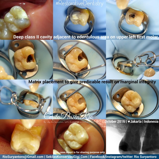 dokter-gigi-rio-suryantoro-spesialis-konservasi-gigi-terbaik-jakarta-rk-26-eden-andy-pi