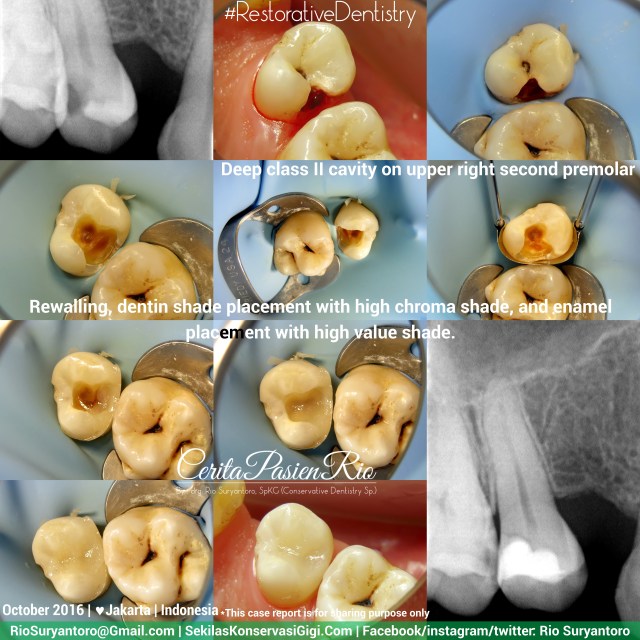 dokter-gigi-rio-suryantoro-spesialis-konservasi-gigi-terbaik-jakarta-rk-26-herdiman-pi